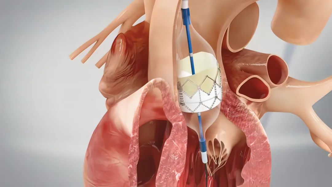 jk2024013105.jpg jk2024013105.jpg